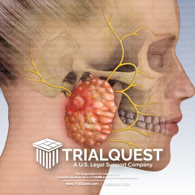 Parotid Gland and Facial Nerve - TrialExhibits Inc.